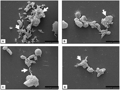 Induction of NETosis in ovine colostral PMN upon exposure to Neospora caninum tachyzoites